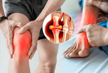 Schéma nanášania gélu Icexin na oblasť kolenného kĺbu a chodidla